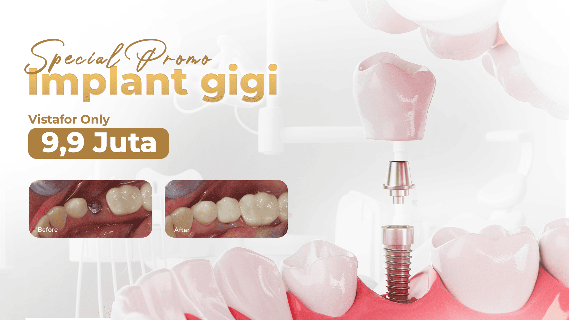 Smile Lab Hero Slide 2